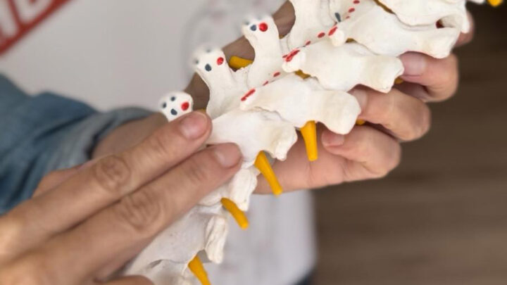 Aura + Técnica estructural